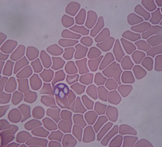 Babesia SP